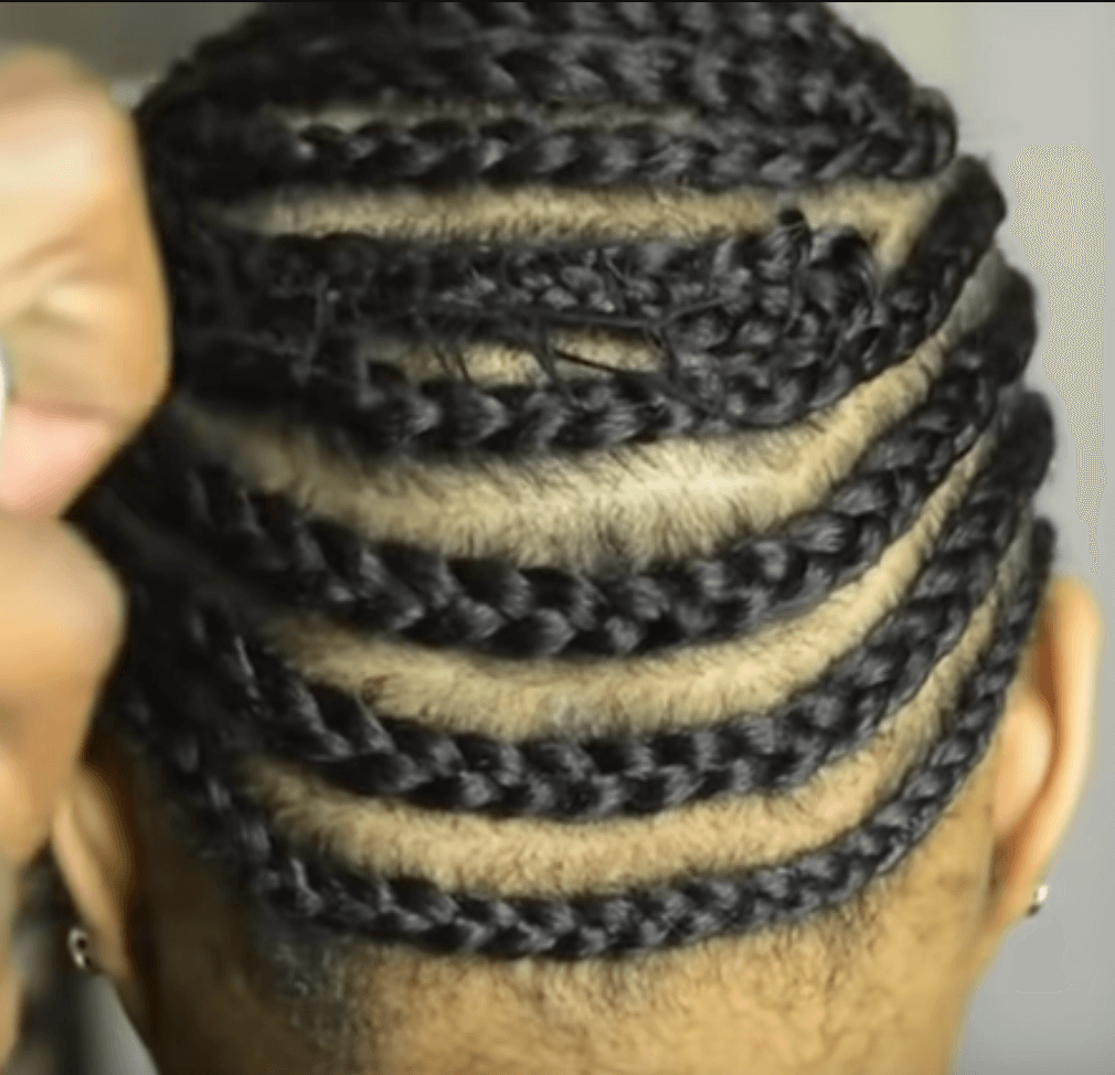 tresses pour tissage alopécie de traction