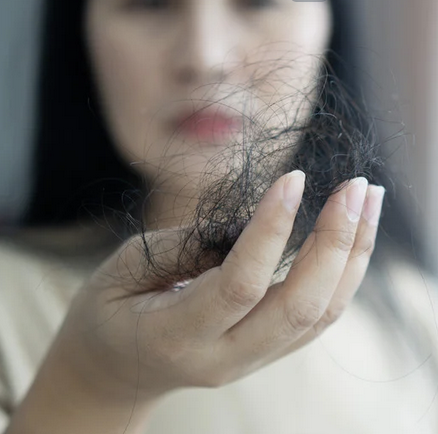 chute de cheveux hormonale femme